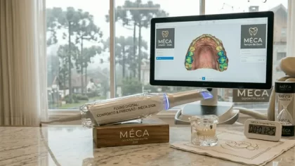 Scanner Intraoral: adeus á moldagem com massinha